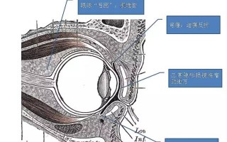 为什么隐形眼镜是软的，为什么隐形眼镜是软的呢